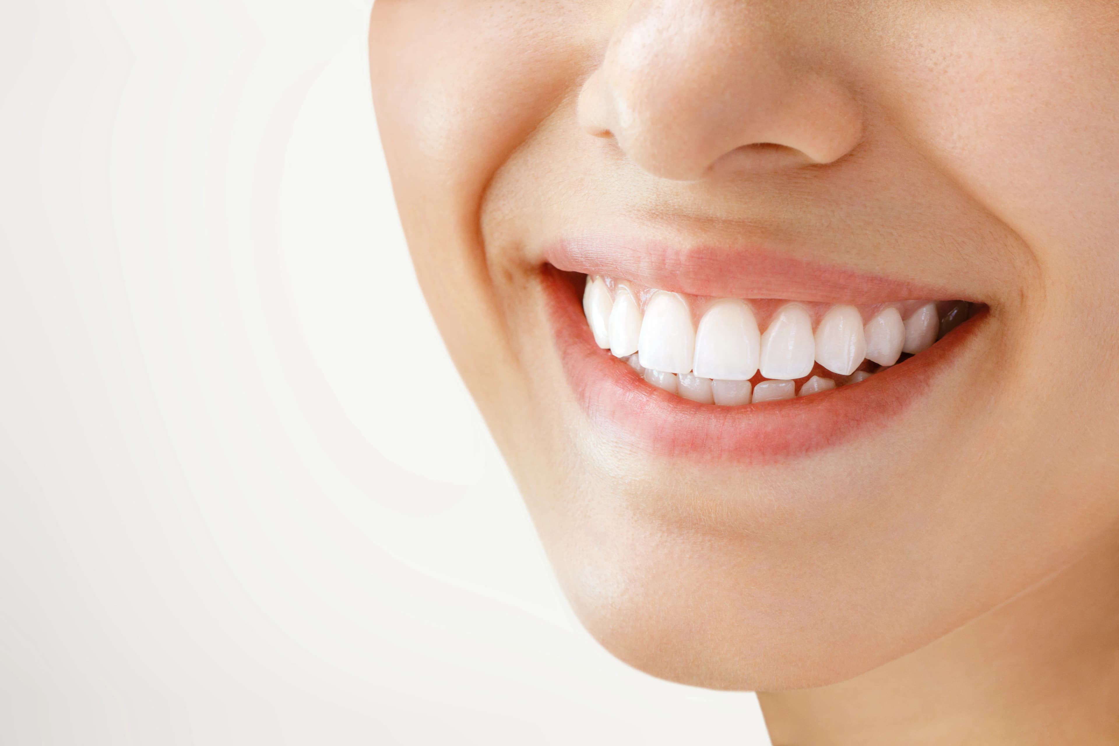 Porcelain Veneers